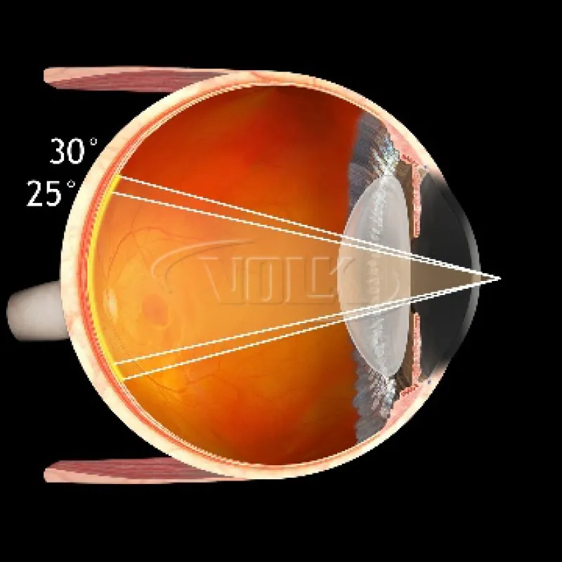 Купити Fundus 20mm Україна
