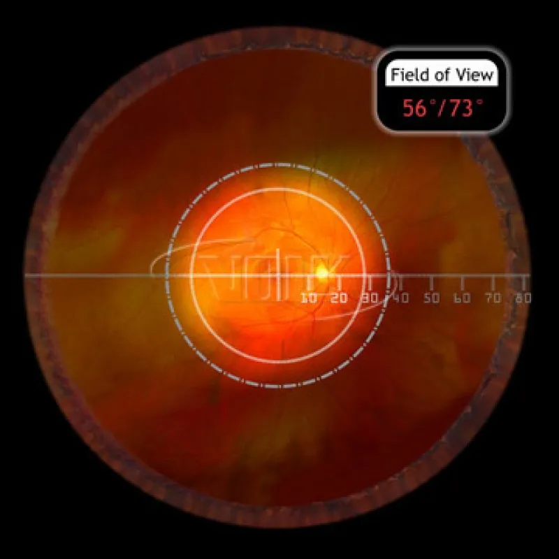 Купити Класична лінза Pan Retinal® 2.2 Україна
