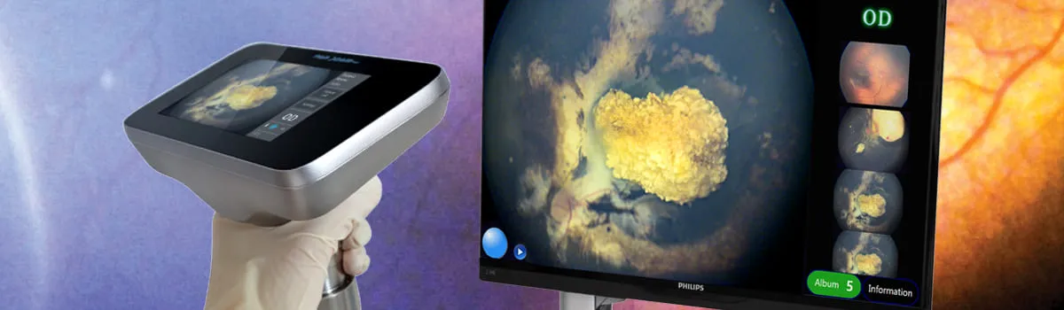 Купити Педіатрична система PanoCam PRO Україна
